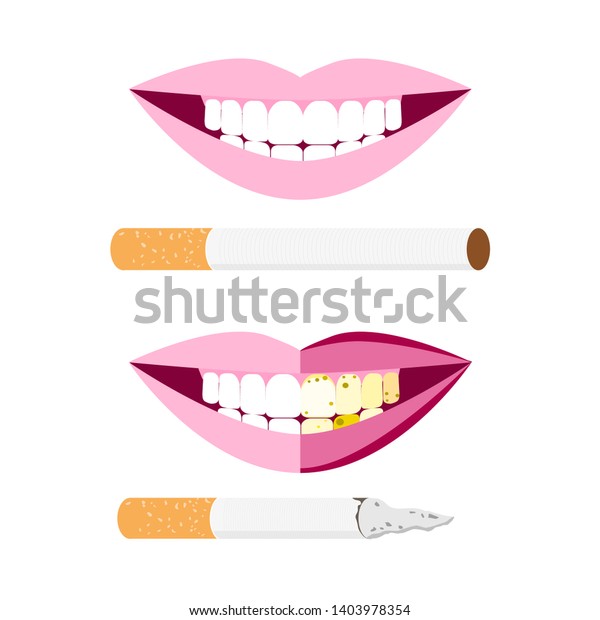 Awareness Smoking Beauty Teeth Dirty Teeth Stock Vector (Royalty Free ...