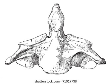 Axis (human second cervical vertebra), vintage engraved illustration. Usual Medicine Dictionary - Paul Labarthe - 1885.