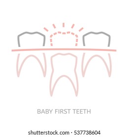 Baby First Tooth Icon. Vector Illustration In Pink And Grey Colours Isolated On A White Background. Medicine, Healthcareand And Childhood Concept.