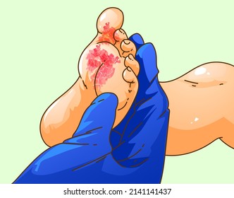 Baby foot with skin disease. Itching, scabies. Healthcare illustration. Vector illustration.