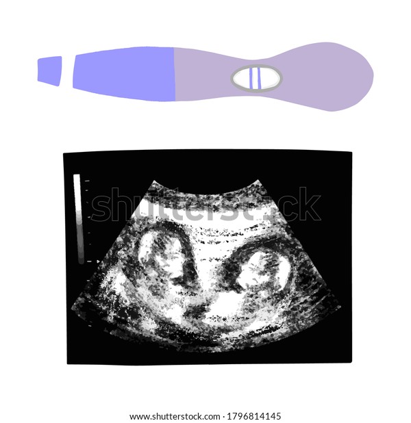 Baby girl twins ultrasound picture. 