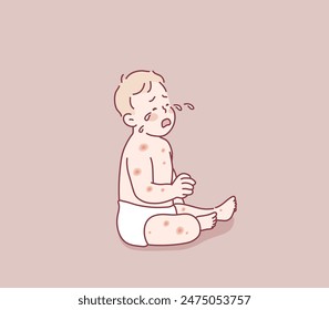 Baby having eczema skin problem on face. Hand drawn style vector design illustrations.