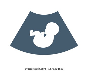 The Baby silhouette in ultrasound scan. Isolated Vector Illustration