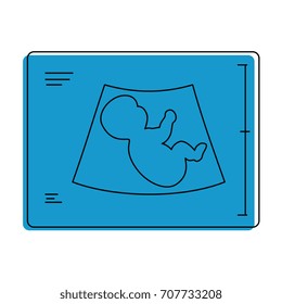 baby Ultrasound isolated icon