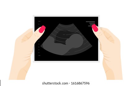 Baby ultrasound picture in womans hands flat vector illustration. Fetus silhouette in mother womb, pregnancy diagnostic sonography or ultrasonography concept isolated on white background