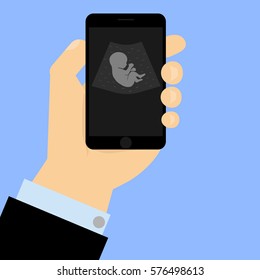 Baby in womb drawn on phone screen