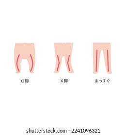 Baby's legs shape change without line. "OKYAKU" means O legs. "XKYAKU" means X legs. "MASSUGU" means straight.