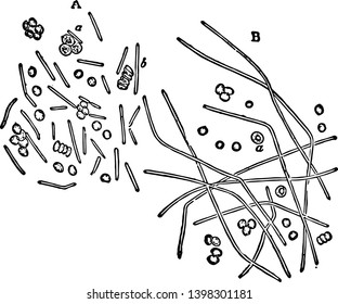 Bacilli vermischte sich mit Blutkörperchen aus dem Blut einer Perlmutter bis hin zu einer Vintage-Linie Zeichnung oder Gravitation Illustration.