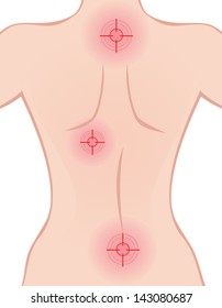 Back pain vector illustration.