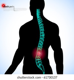 Back pain. Vector illustration.