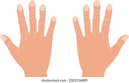 back of a person's hand wide open