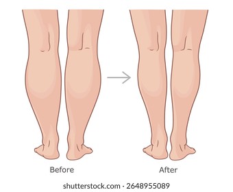 Vista de trás dos panturrilhos antes e depois da perda de peso. Emagrecimento da ilustração do vetor de panturrilhas.