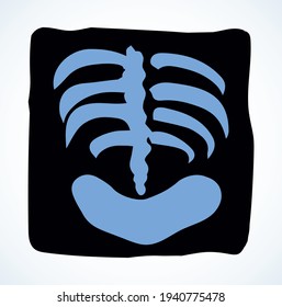 Back view hip joint part sick ache therapy checkup test biology system rontgen. black hand drawn medic doctor lab female spinal rib ill lung pain exam picture logo sign pictogram line sketch cartoon