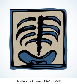 Back view hip joint part sick ache therapy checkup test biology system rontgen. black hand drawn medic doctor lab female spinal rib ill lung pain exam picture logo sign pictogram line sketch cartoon
