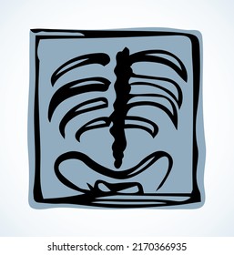 Back view hip joint part sick ache therapy checkup test biology system rontgen. black hand drawn medic doctor lab female spinal rib ill lung pain exam picture logo sign pictogram line sketch cartoon