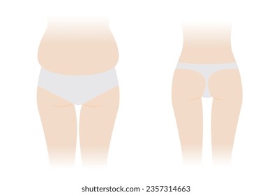 Back view of woman body fat and slim vector illustration isolated on white background. Comparison of woman with fat buttocks, hip, thigh and slender body. Before and after weight loss.
