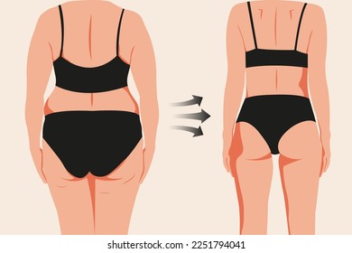 Vista posterior del cuerpo de una mujer antes y después de perder peso. Ilustración vectorial en estilo plano para crear contenido de fitness