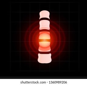 Backache poster template. Pain Spinal disc herniation symptoms infographic element. Concept design for clinic. Isolated vector illustration on black background.
