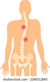 Backbone pain. Spine ache icon. Vertebral column diagram isolated on white background