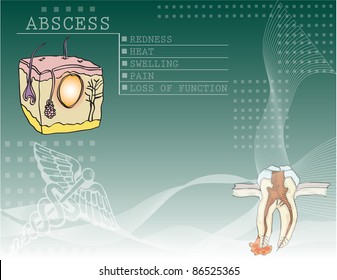 The background to the disease abscess with illustrations and medical symbols.
