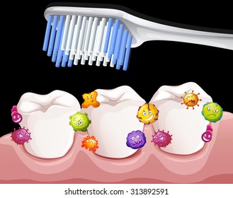 Bakterien zwischen den Zähnen bei der Putzgrafik