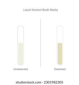 The bacteria culture in Liquid Nutrient Broth Media that shows the Undetected and Detected.