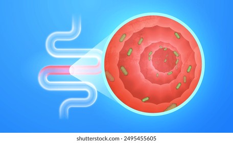 Bakterien Helicobacter pylori Infektion Prozess im Magen verursacht gesundheitliche Probleme. Detaillierter Nahbereich entzündeter Darm mit schädlichen Bakterien - Konzept Gastroenterologie Verdauung