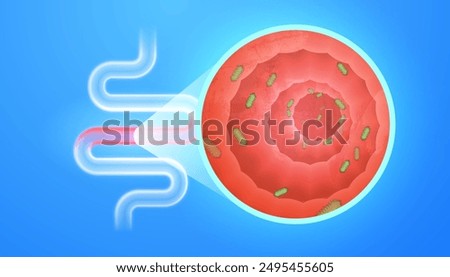 Bacteria Helicobacter pylori infection process in stomach causes health problems. Detailed close-up cross-section of inflamed intestine with harmful bacteria - concept gastroenterology digestive