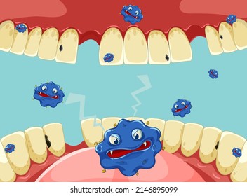 Bacteria Inside Human Mouth Illustration