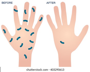 bacteria on hand vector , before after