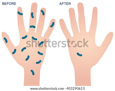 bacteria on hand vector , before after