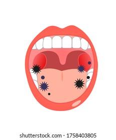 Bacteria and oral cold symptom coronavirus,get cold