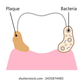 bacterias y placa de fijación en diente. Ilustración inicial de biofilm dental. concepto de salud dental y cuidado bucal
