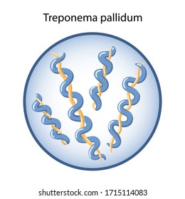 Bacteria Treponema Pallidum In Magnifying Glass Is Causative Agent Of Syphilis (sexually Transmitted Disease). Microbiology. Vector Illustration In Flat Style Isolated Over White Background