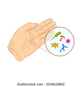 Bacteria and viruses on human skin. Germs on skin through a magnifying glass. Concept of infection, diseases, influenza, epidemic.