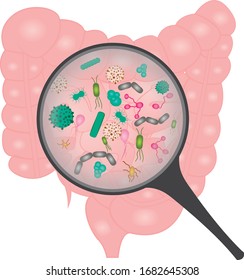 Bacterial Overgrowth In Small  Intestine. Bacteria Under A Magnifying Glass  Vector Illustration