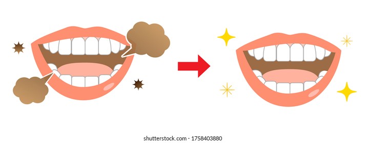 Bad breath dental care cough