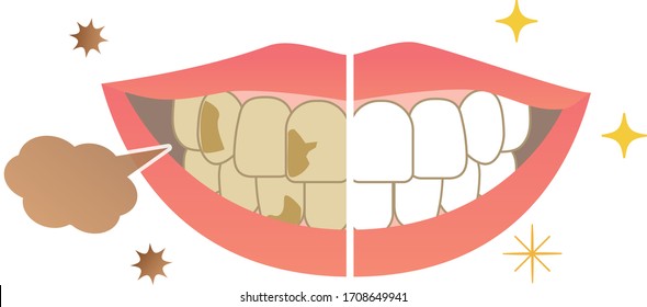 
Bad breath from the mouth and whitening