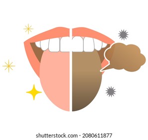 Bad breath and tongue stains Oral care illustrations
