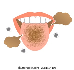 Bad breath and tongue stains Oral care illustrations
