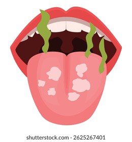 Bad breath and white tongue caused by bacteria and poor hygiene representing oral health problems