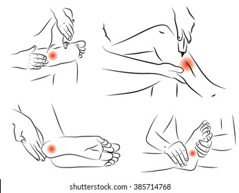 Bad foot. Foot of the woman. Pain in joints of he feet, knee, shin, foot cream for athletes, a man clinging to the leg, a series of drawings. scribble cartoon vector. hand drawn women feet
