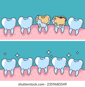 Malo diente bueno en la boca tratamiento dental concepto limpio. Ilustración de diseño gráfico plano vectorial
