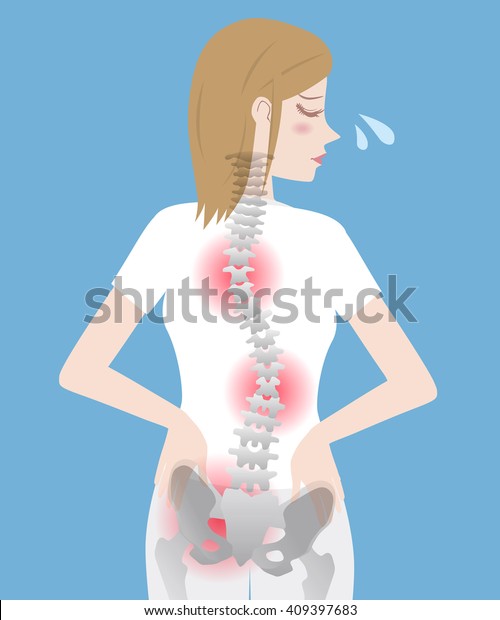 Schlechte Korperhaltung Frauenkorper Silhouette Und Ruckgrat Chiropraktisches Stock Vektorgrafik Lizenzfrei
