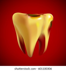 Bad sick yellow tooth with caries. Vector illustration.