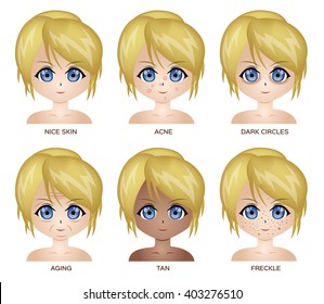bad skin vector cartoon , uv , old , pimple . character