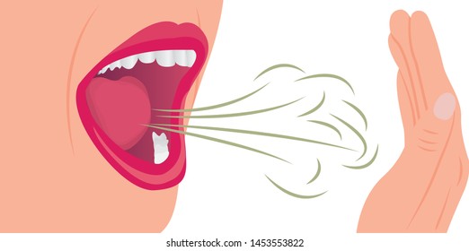 Bad Smell Air From A Mouth. Oral Hygiene Concept Vector Illustration On A White Background.