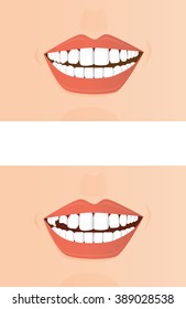 Bad tooth illustration. 
