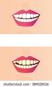 Bad tooth illustration. Teeth whitening illustration.