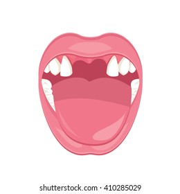 Bad tooth illustration. vector
